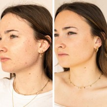 SÉRUM LOCAL ANTI-IMPERFECTIONS